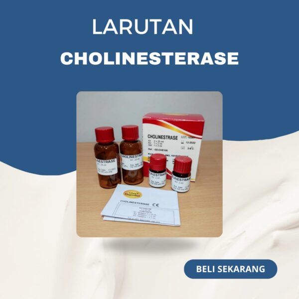 Reagen Cholinesterase Glory