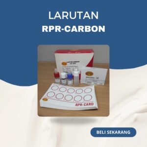 RPR-Carbon 100 tests