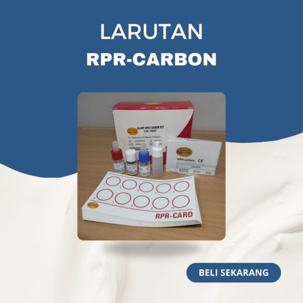 RPR-Carbon 100 tests