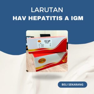 HAV HEPATITIS A IgM