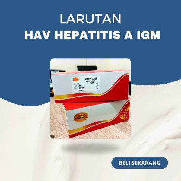 HAV HEPATITIS A IgM