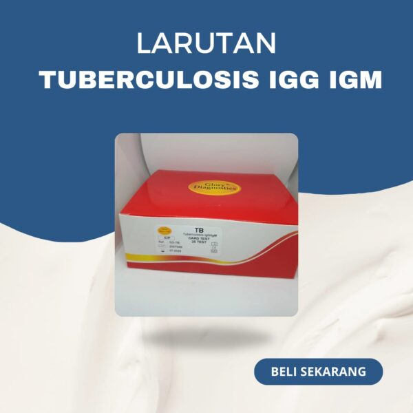 TUBERCULOSIS IgG IgM