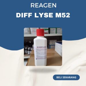 Diff Lyse M52