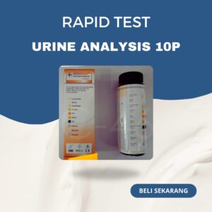 Strip Urine Analysis 10P Test Nova