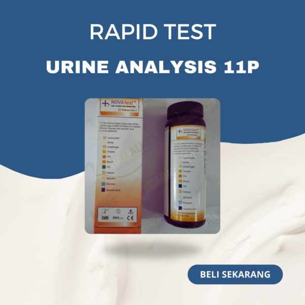 Strip Urine Analysis 11P Test Nova
