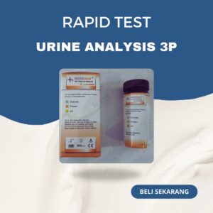Strip Urine Analysis 3P Test Nova